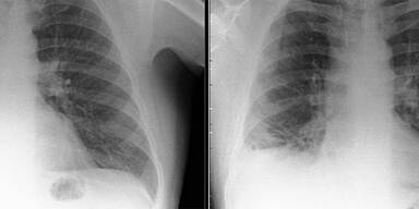 Die &Auml;rzte dachten an Krebs, doch dann fanden sie DAS