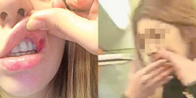 Brutale Attacke U1 Reumannplatz