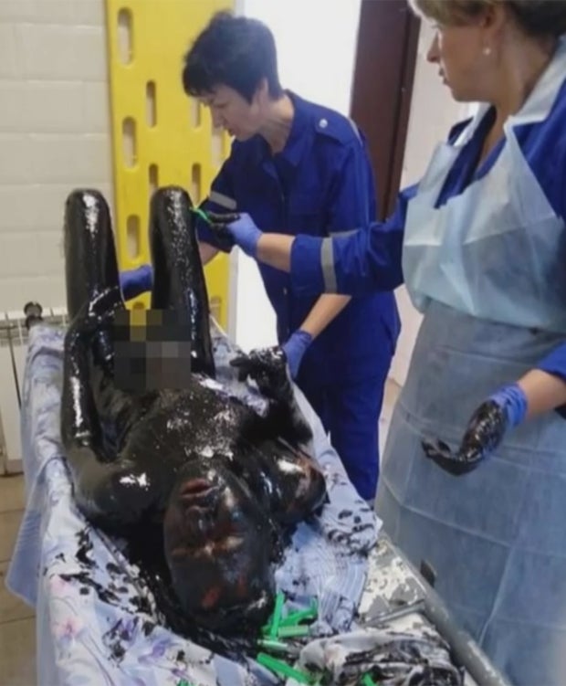 Mann fällt in Teergrube und überlebt wie durch ein Wunder