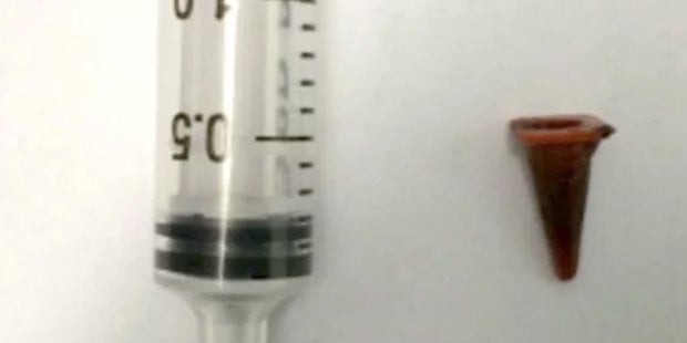 Die Ärzte dachten an Krebs, doch dann fanden sie DAS