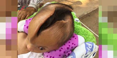 Kopf gespalten Pheaktra Pov