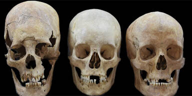 R&auml;tsel um "Alien-Sch&auml;del" gel&ouml;st