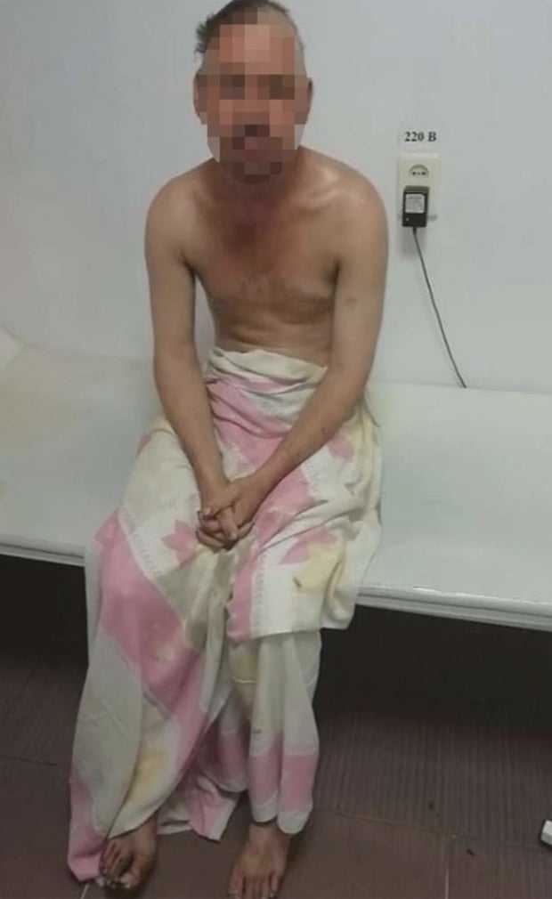 Mann fällt in Teergrube und überlebt wie durch ein Wunder