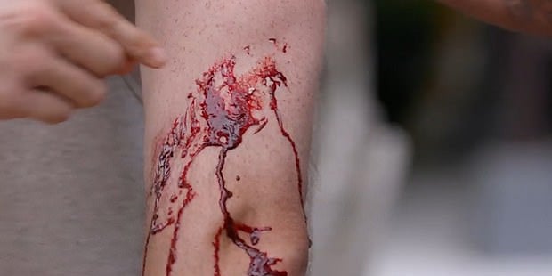 Wissenschaftler lässt sich von Python blutig beißen