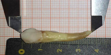 L&auml;ngster Zahn der Welt