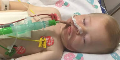 Baby bei&szlig;t in Waschmittel-Kapsel &ndash; Koma!