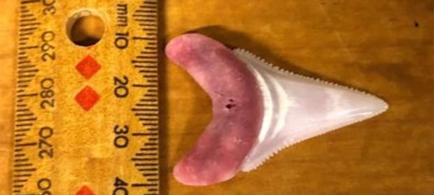 Surfer verblutet nach Hai-Attacke