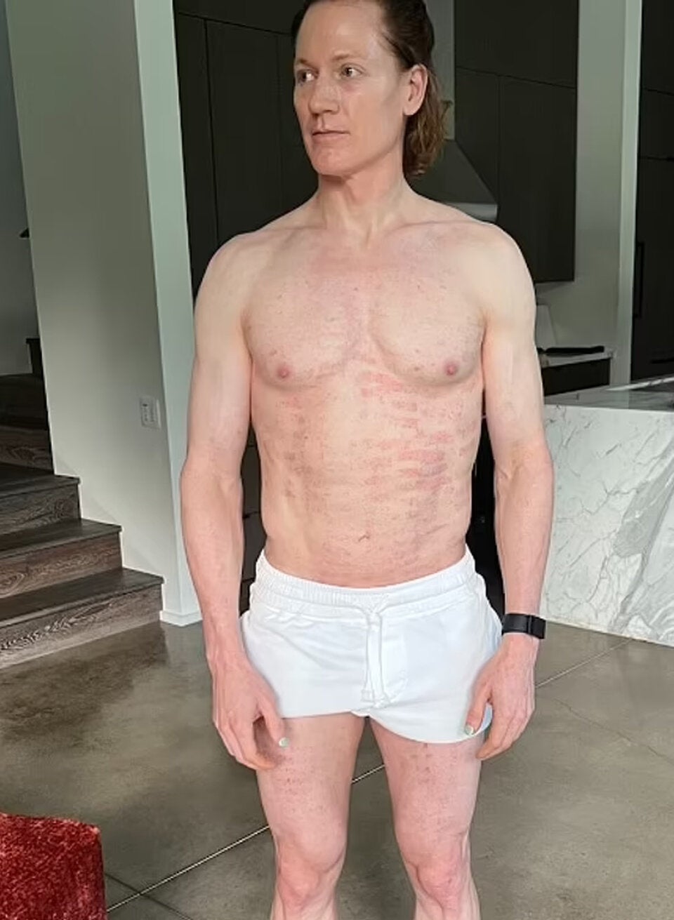 Milliardär (45) zahlt Millionen für Körper eines 18-Jährigen