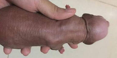 Penis Puppy