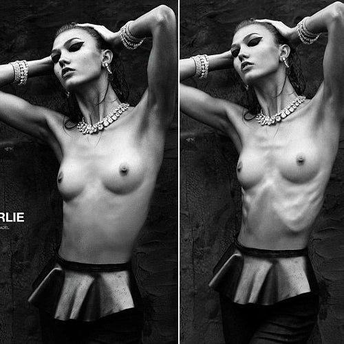 Karlie Kloss: Magazin retuschierte ihre Rippen