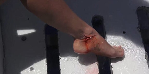 Sexy Porno-Star von Hai attackiert