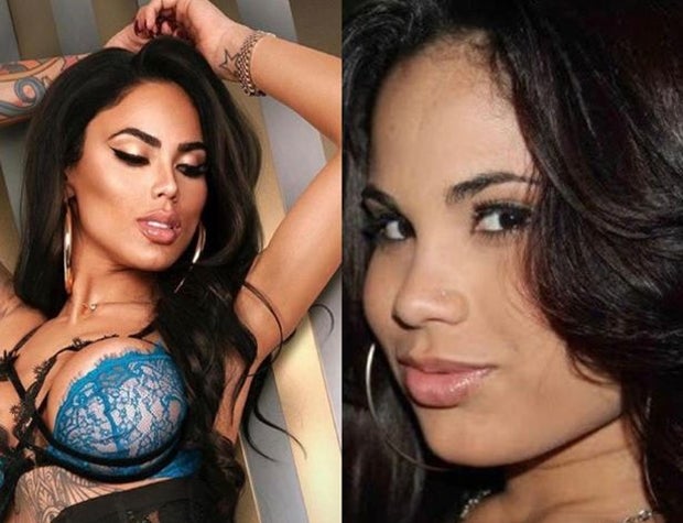 Playboy-Model zeigt, wie sie vor 50 Schönheits-OPs aussah