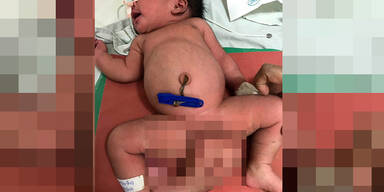 Baby mit drei F&uuml;&szlig;en