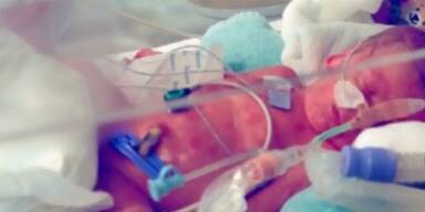 9-jähriges Mädchen bringt Baby zur Welt