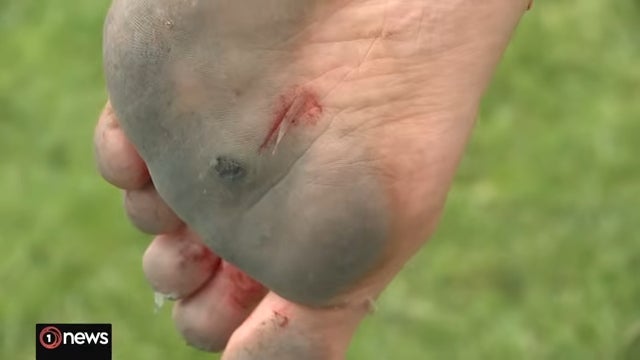 Der Rekord war erfolgreich – aber die Füße blieben nicht ganz ohne Schrammen.