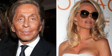 Tanorexia: Die Sucht der Stars nach Farbe