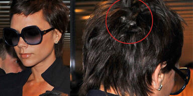 Gehen Victoria Beckham die Haare aus?