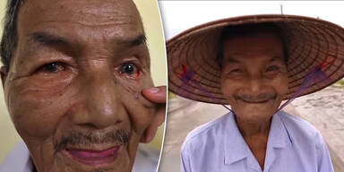 &Auml;rzte ratlos: 83-J&auml;hriger ist seit &uuml;ber 60 Jahren wach