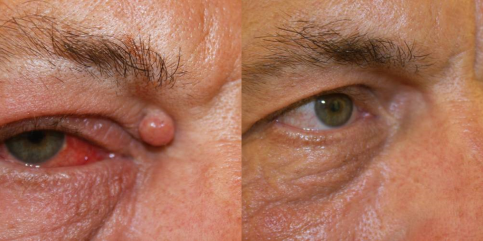 Schöne und gesunde Haut mit dem Laser