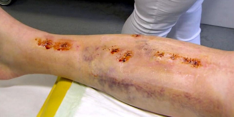 Nina Ortlieb zeigt Horrorverletzung und verspricht: 