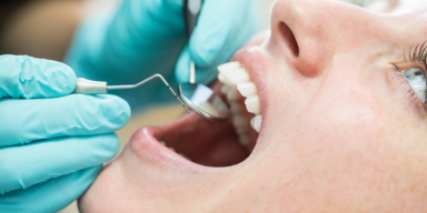 Zahn&auml;rztesagen sehen ob Sie einen Blow Job gegeben haben