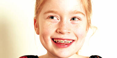 Gratis-Zahnspange fix &ndash; Starttermin ist Juli