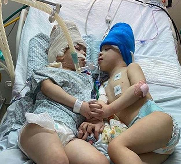 27 Stunden: Zwillinge (3) wurden getrennt