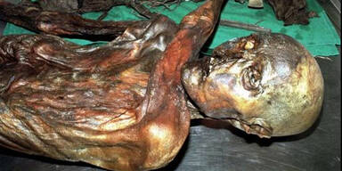 Ötzi nach dem fund