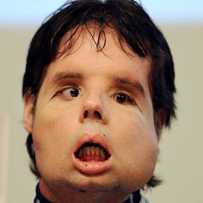 Oscar mit seinem neuen Gesicht