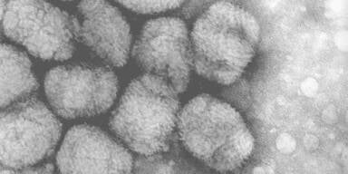 Affenpocken: In diesen EU-L&auml;ndern gibt es die meisten F&auml;lle