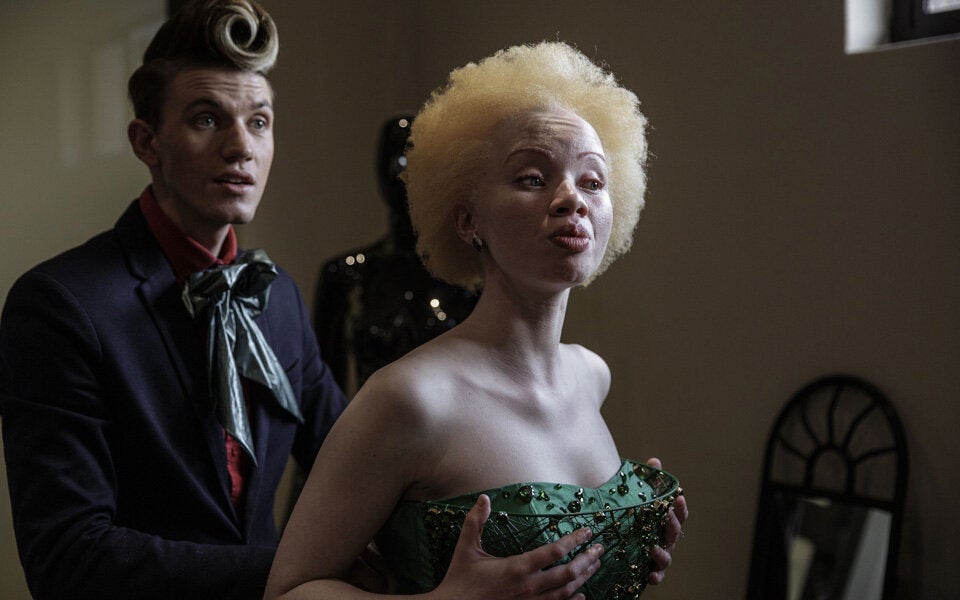 Albino-Model kämpft gegen Vorurteile