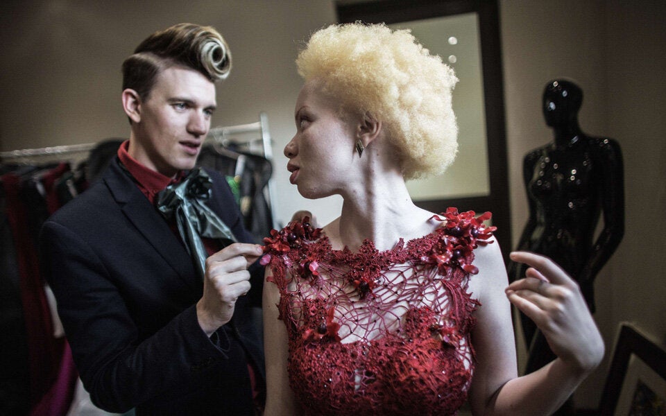 Albino-Model kämpft gegen Vorurteile