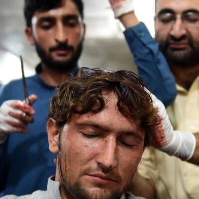 Mehrere Tote und Verletzte