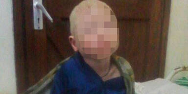 Albino-Junge: Hand f&uuml;r Liebestrank