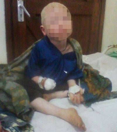 Albino-Junge: Hand für Liebestrank