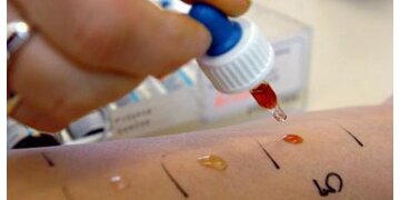 allergietest