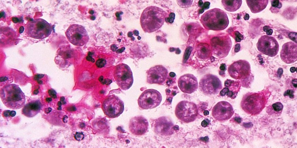 Amöbe Mikroskopabsicht