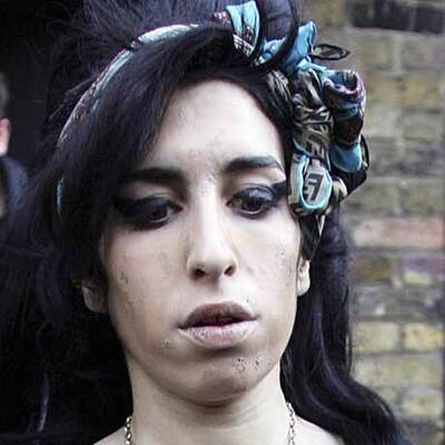 Die Stars mit der schlechtesten Haut