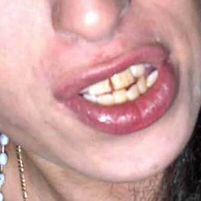 Schneekönigin Amy feiert mit Freunden