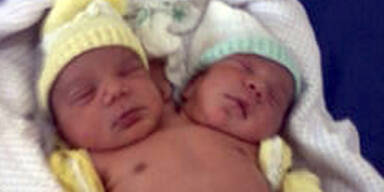 Zwillinge in einem Körper