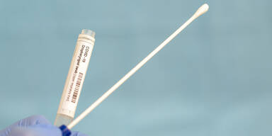 China testet jetzt per Anal-Abstrich auf Corona