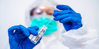 China testet per Anal-Abstrich auf Corona-Infektion