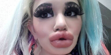 SIE hat die dicksten Lippen der Welt