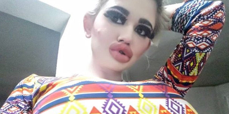 SIE hat die dicksten Lippen der Welt