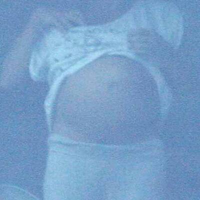 Angelina Jolie im Krankenhaus