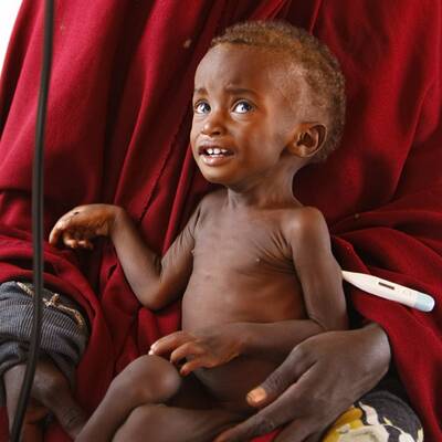Hungersnot in Somalia und Kenia