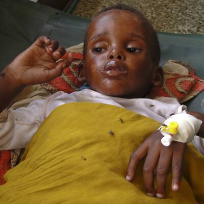 Hungersnot in Somalia und Kenia