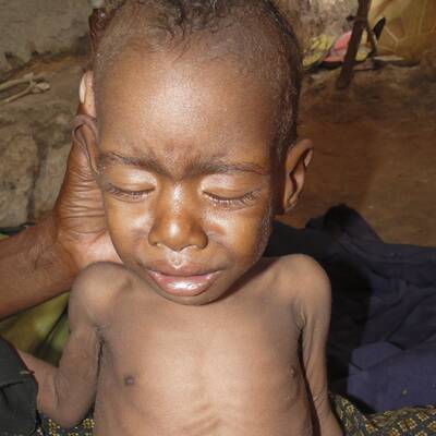 Hungersnot in Somalia und Kenia