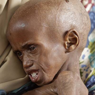 Hungersnot in Somalia und Kenia