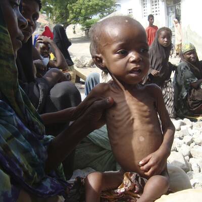 Hungersnot in Somalia und Kenia